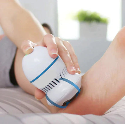Vacuum Callus Remover by Wellness Muse