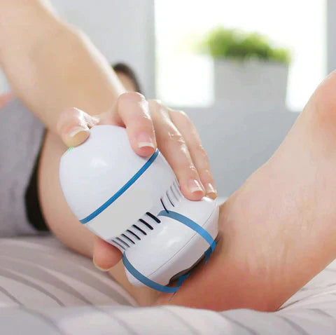 Vacuum Callus Remover by Wellness Muse